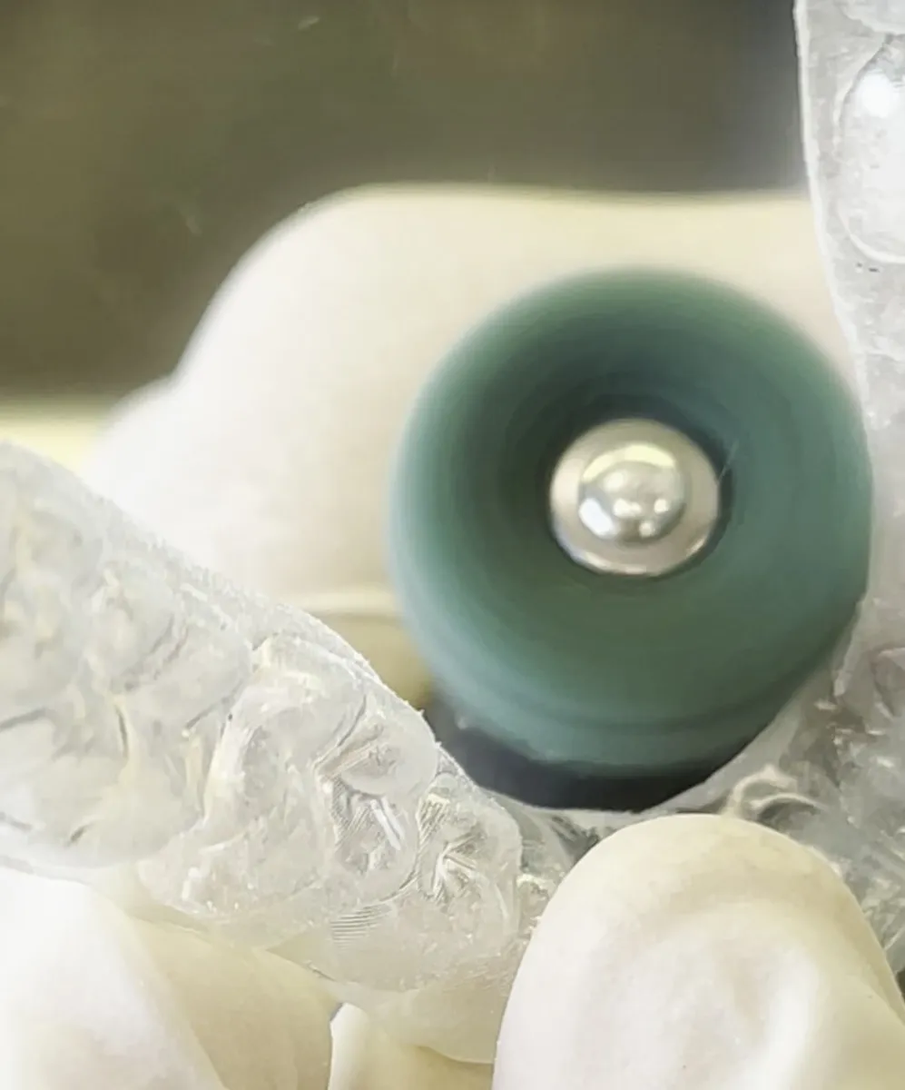 Hand polishing a clear aligner